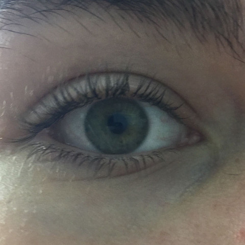 Auge
 - (Augen, Augenfarbe)