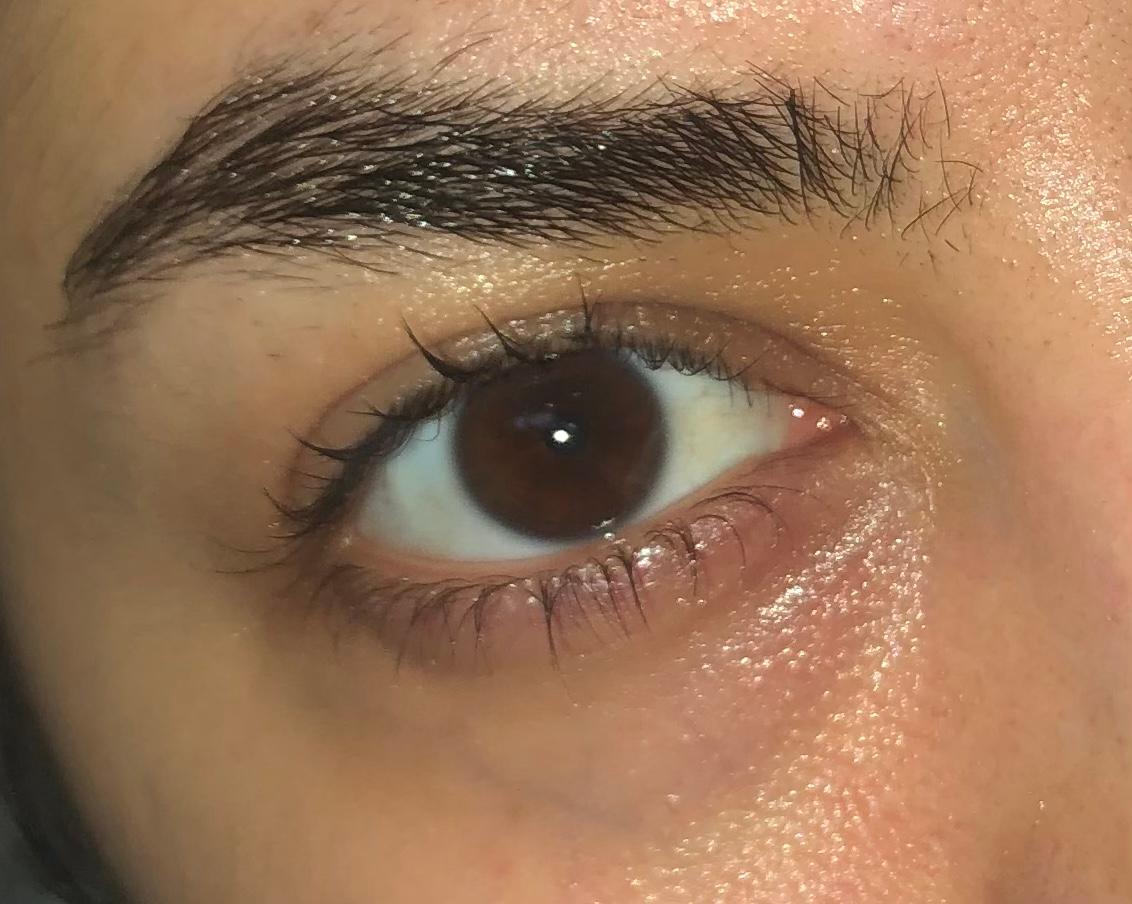 Wieso Habe Ich Immer So Krasse Augenringe Gesundheit Und Medizin