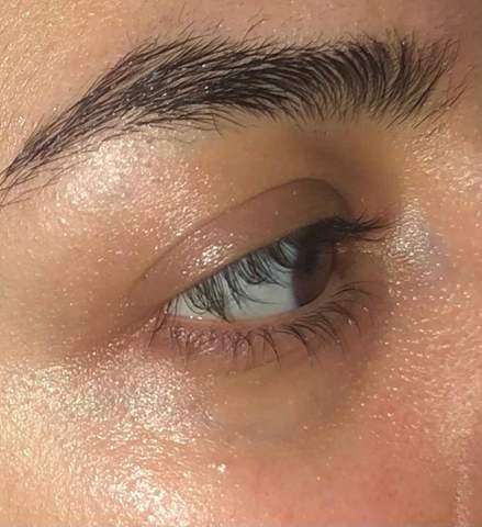 Wieso Habe Ich Immer So Krasse Augenringe Gesundheit Und Medizin