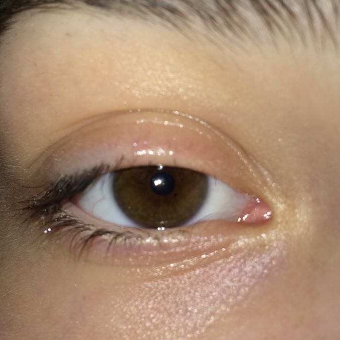 Wieso habe ich keine Wimpern mehr?