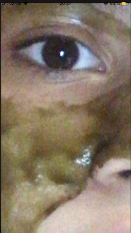 Wieso Hat Mein Auge Einen Weissen Fleck Gesundheit Augen Haushalt Wieso Hat Mein Auge Einen Weissen Fleck Gesundheit Augen Haushalt