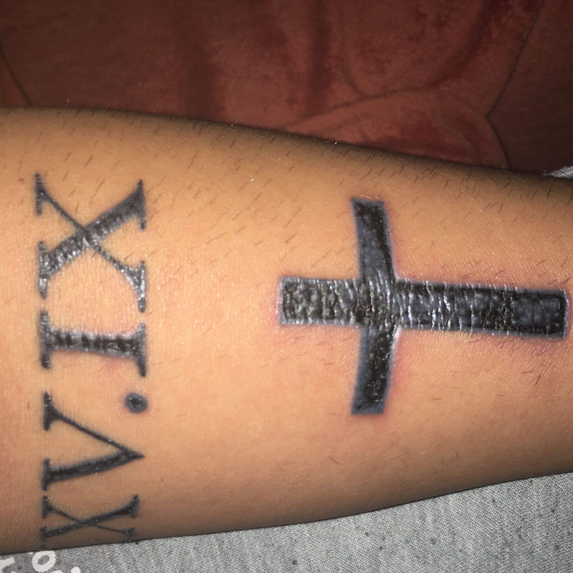 Wieso Vernarbt Ein Tattoos