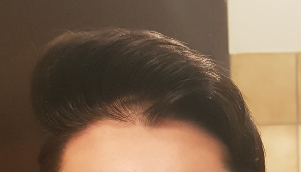 Wieso Kann Ich Meine Kopfhaut Durch Meinen Mittelscheitel Sehen Haare Scheitel