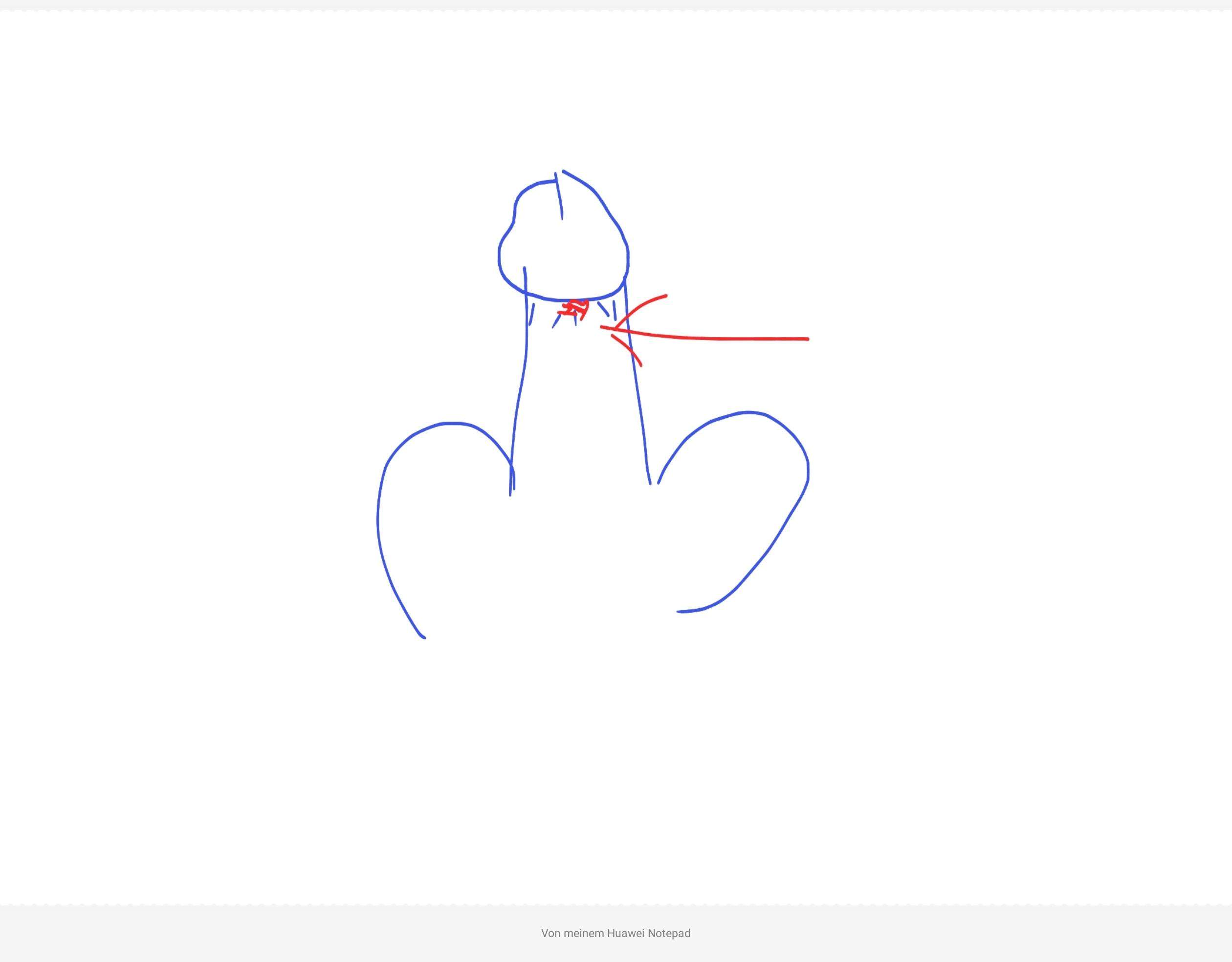 Penis risse am How to