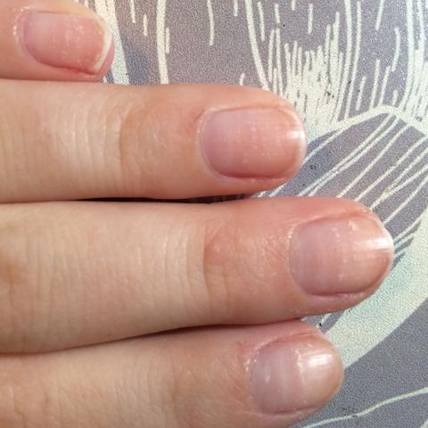 wieso sehen meine nagel so aus kaputt nagellackentferner