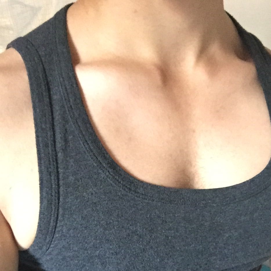 Wieso sieht man meinen Schlüsselbein so