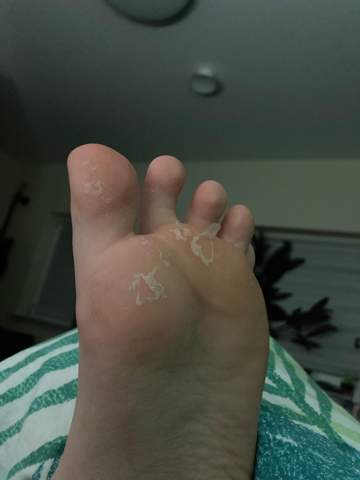 Wieso sieht mein Fuß nach dem duschen so komisch aus?