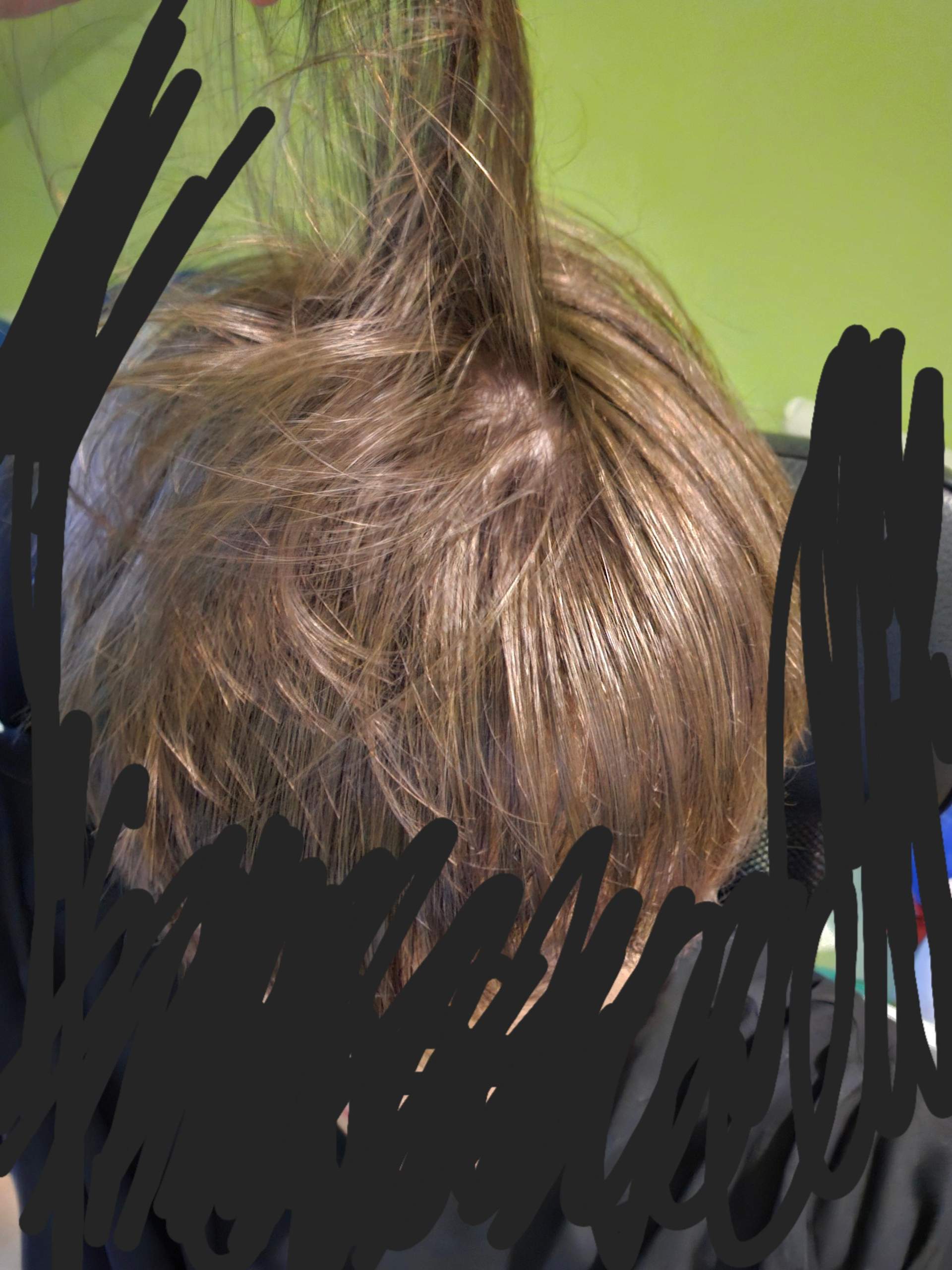 Wieso sind meine Haare so dünn und was kann man dagegen tun? (Jungs ...