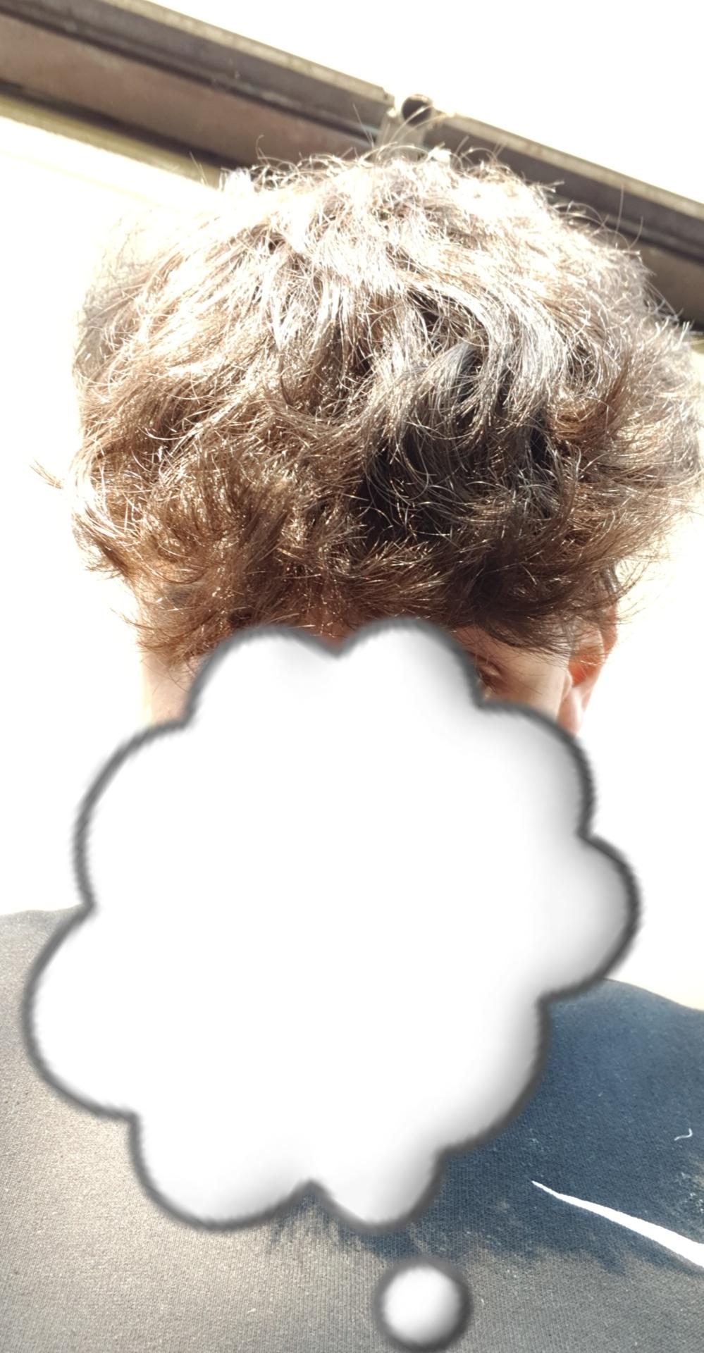 wieso so kaputte dunne haare vorne