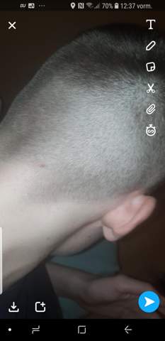 wieso wachsen meine haare so extrem