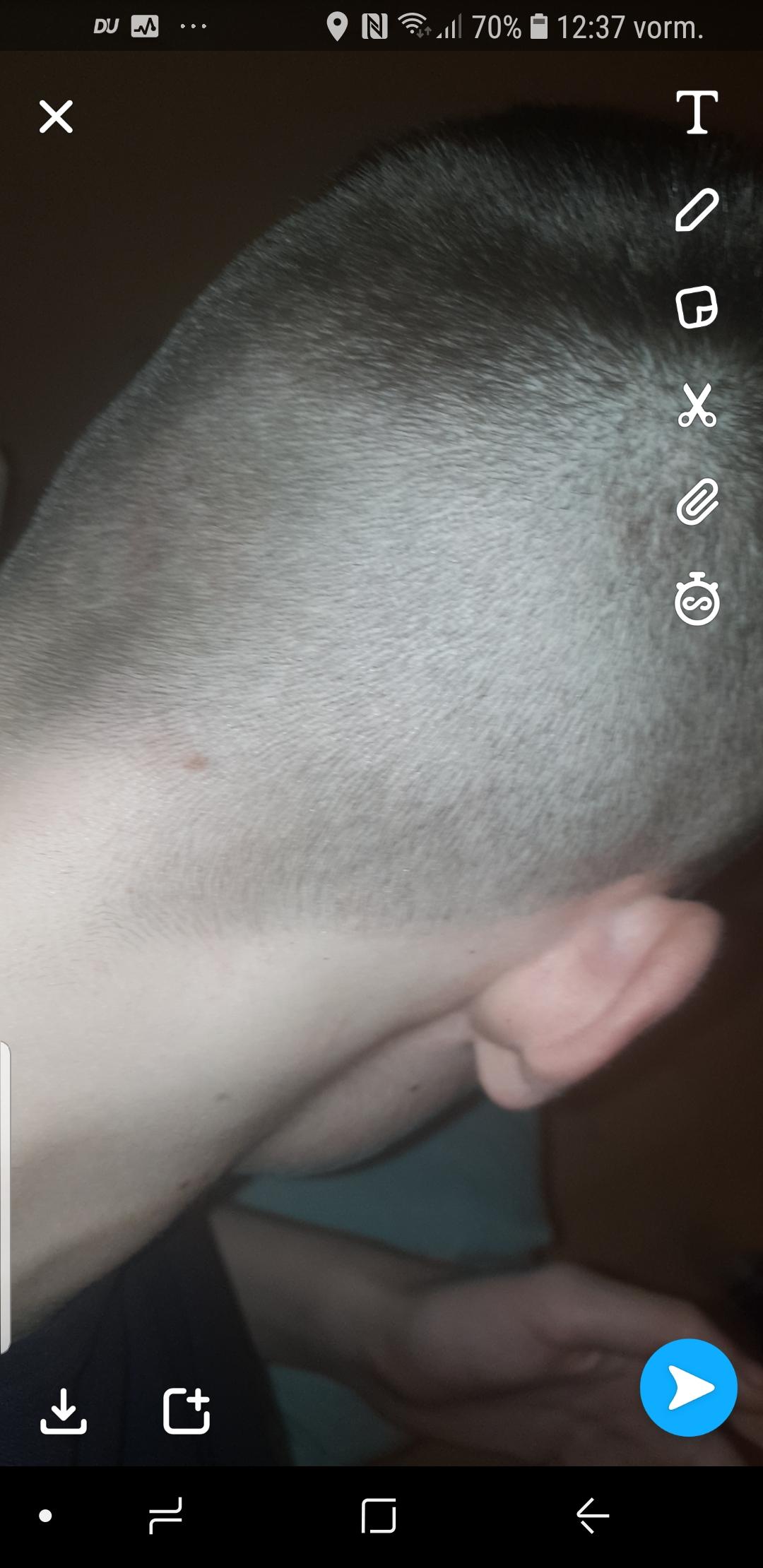 wieso wachsen meine haare so extrem