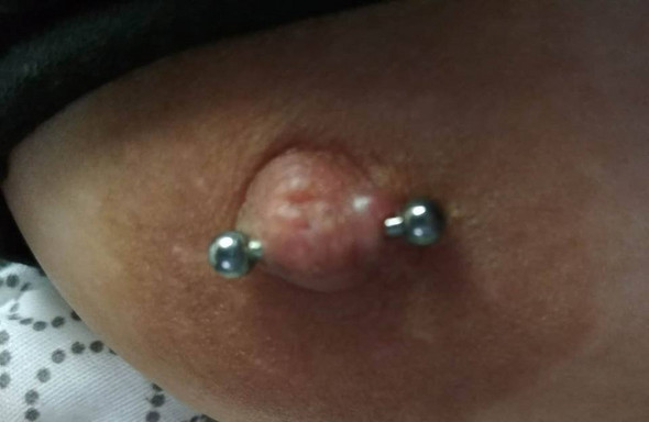 wildes fleisch geht von selbst weg piercing piercer nippel