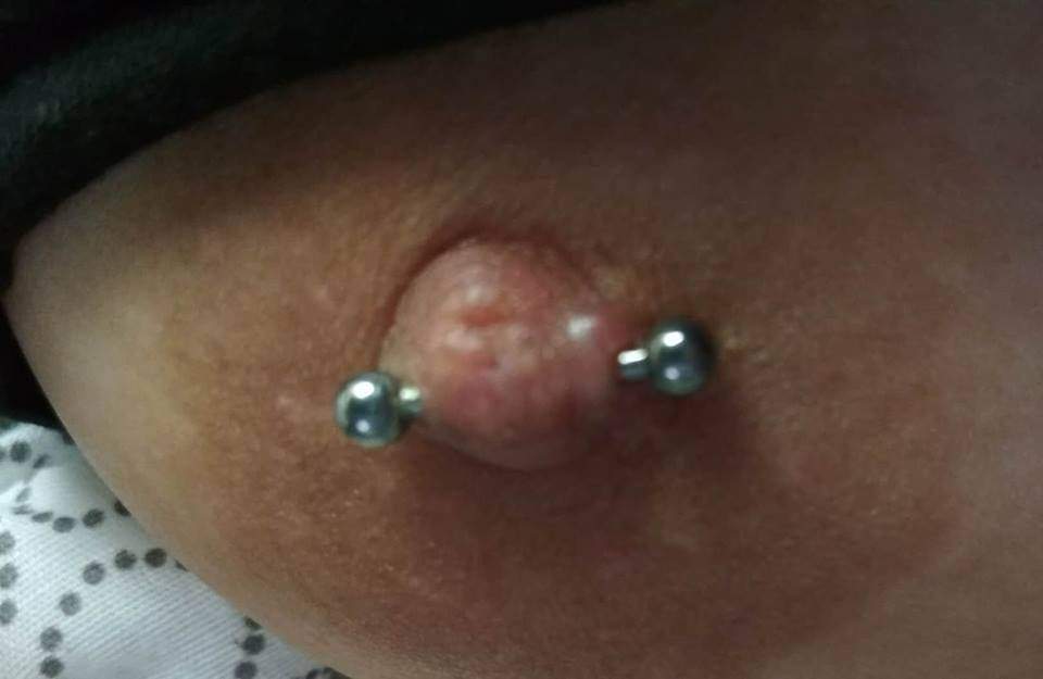 wildes fleisch geht von selbst weg piercing piercer nippel