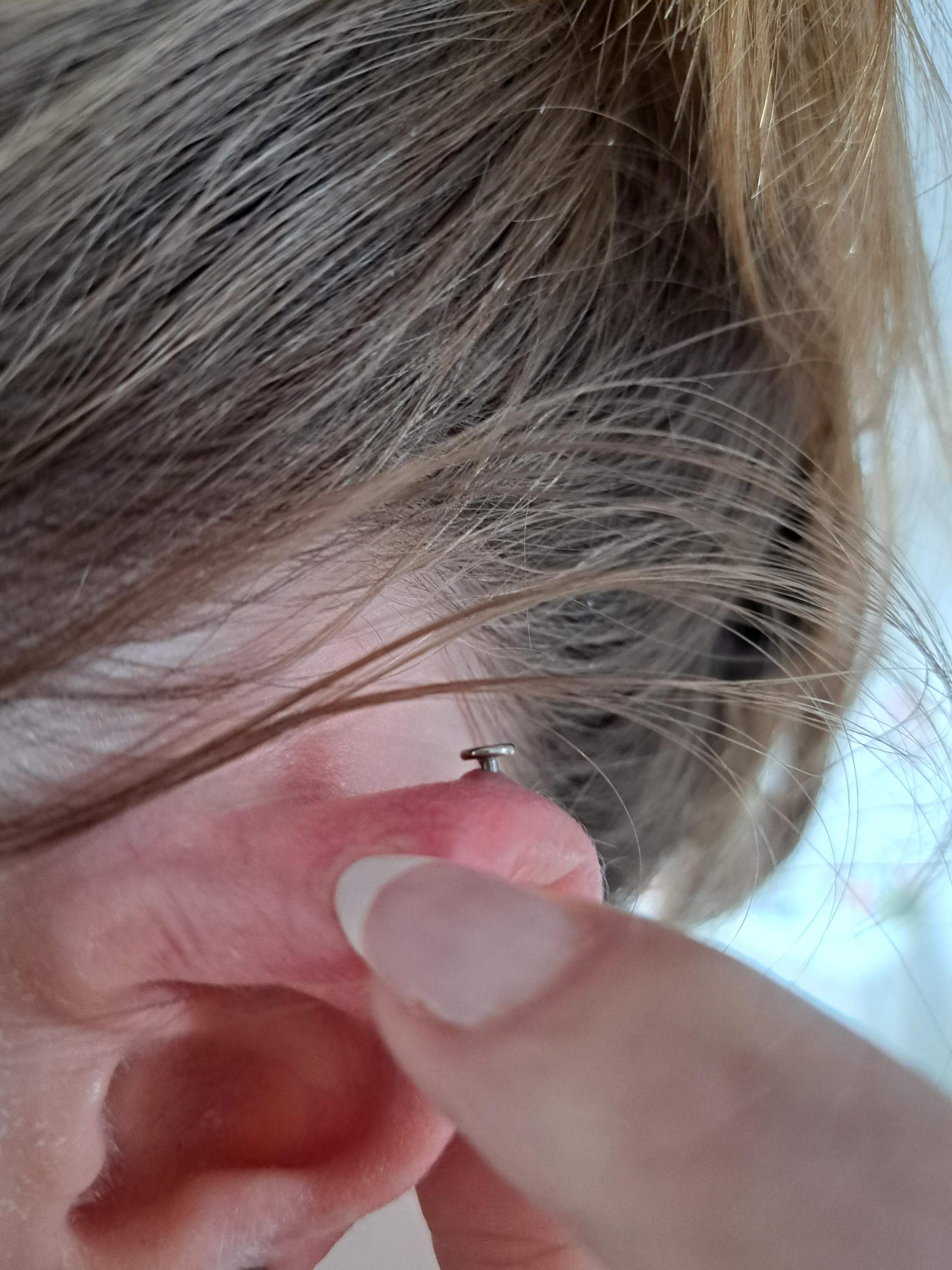 200 Stück Anti Wildfleisch Discs - Silikon Scheiben Für Piercing Stabilisierung