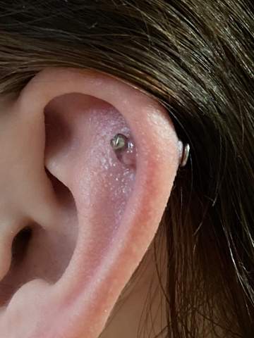 wildfleisch am helix was tun gesundheit und medizin piercing