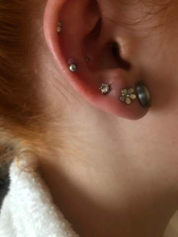 wildfleisch am ohr und piercing entfernen gesundheit und medizin helix wildfleisch am pircing
