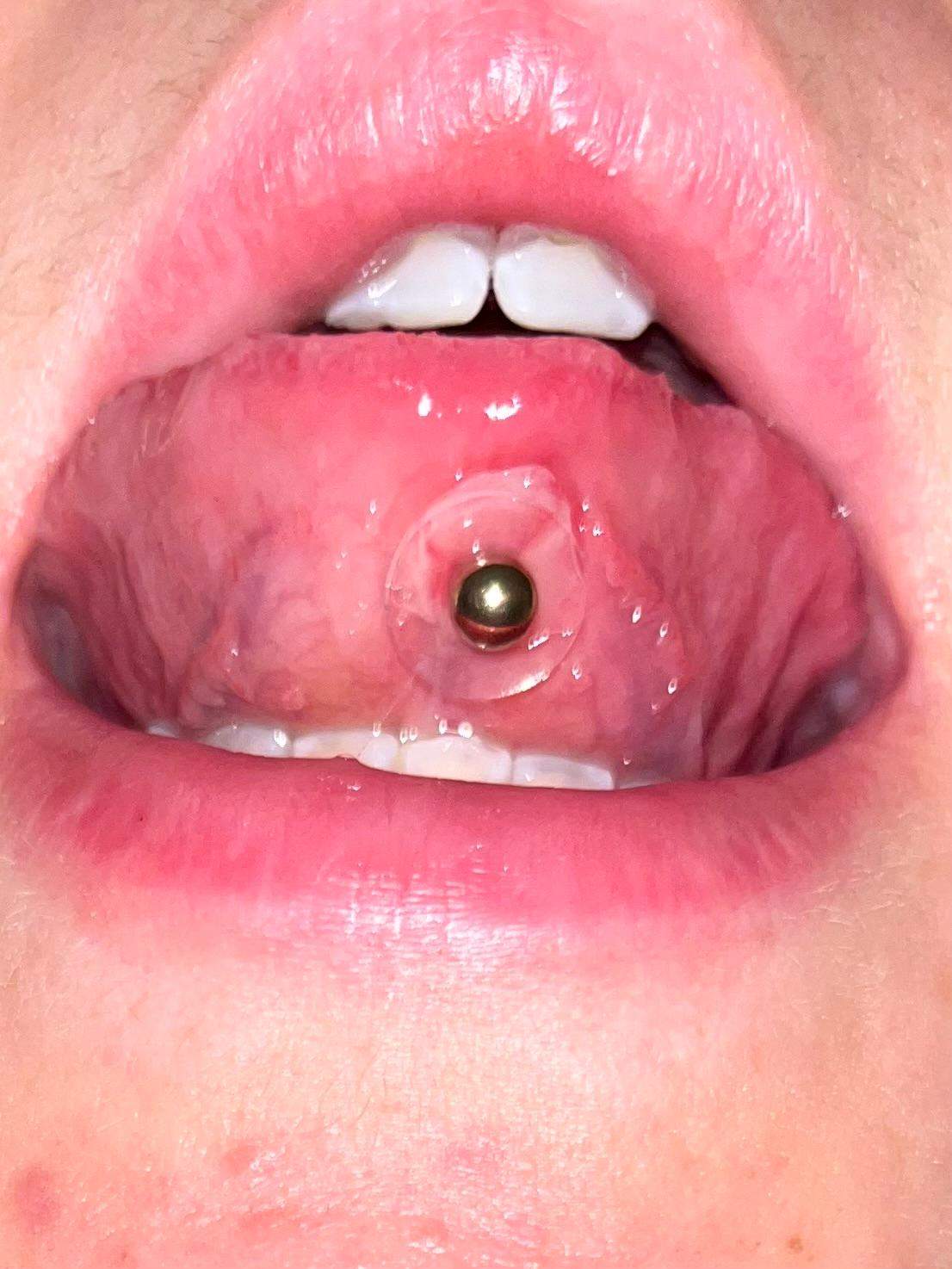 Wildfleisch am Zungenpiercing geht nicht weg. Was tun? (Pflege, Piercing, Zunge)