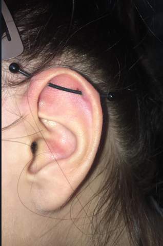 wildfleisch oder nur angeschwollen industrial piercing septum aloe vera octenisept