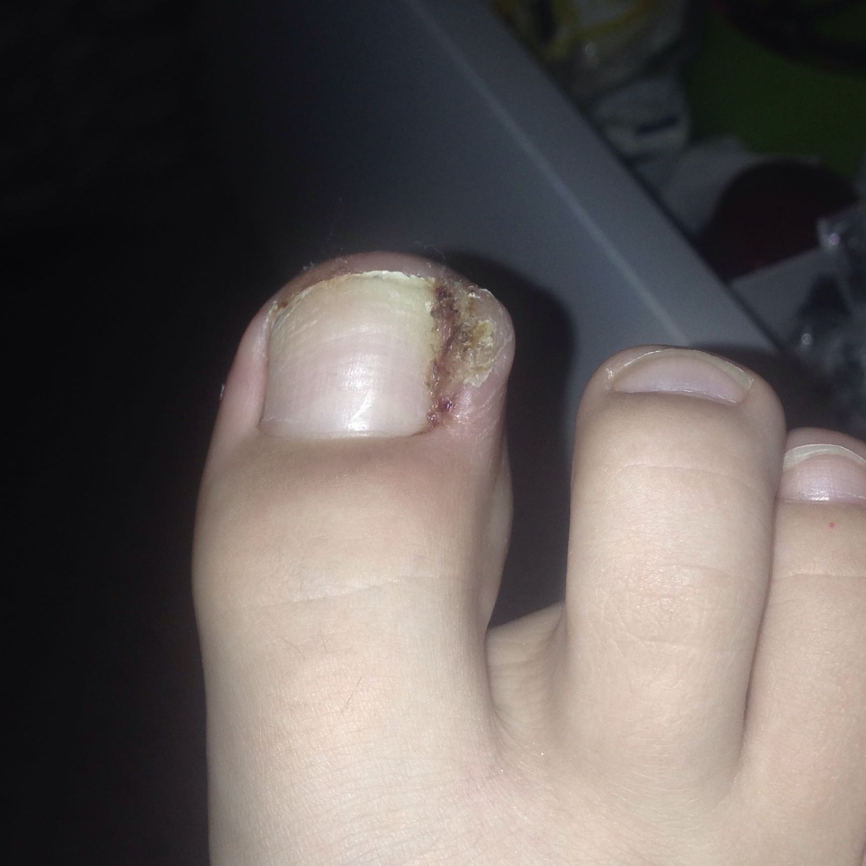 Eiter Im Finger Was Tun - mobinspire