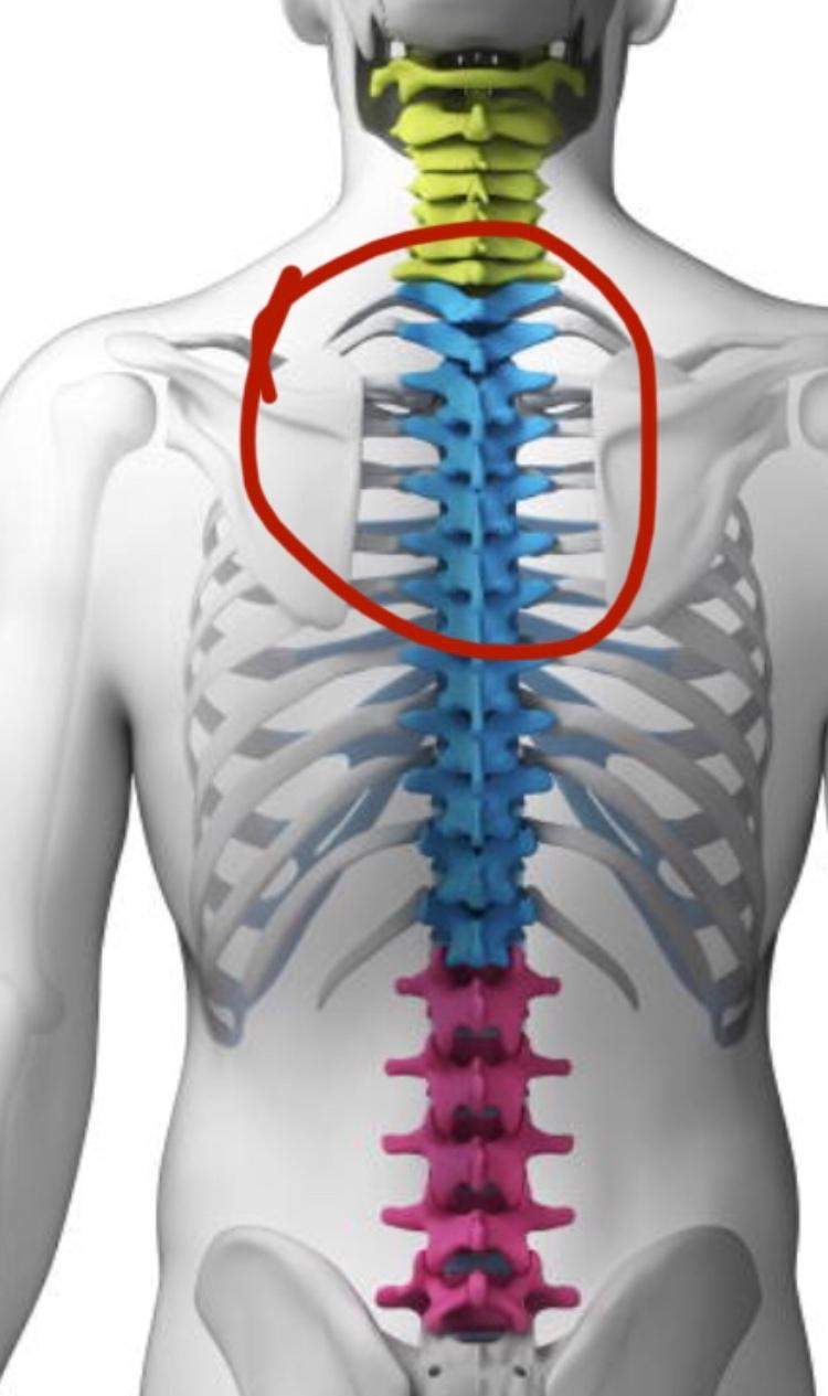 Wirbel tut weh, was tun? (Gesundheit und Medizin, Gesundheit, Wirbelsäule)