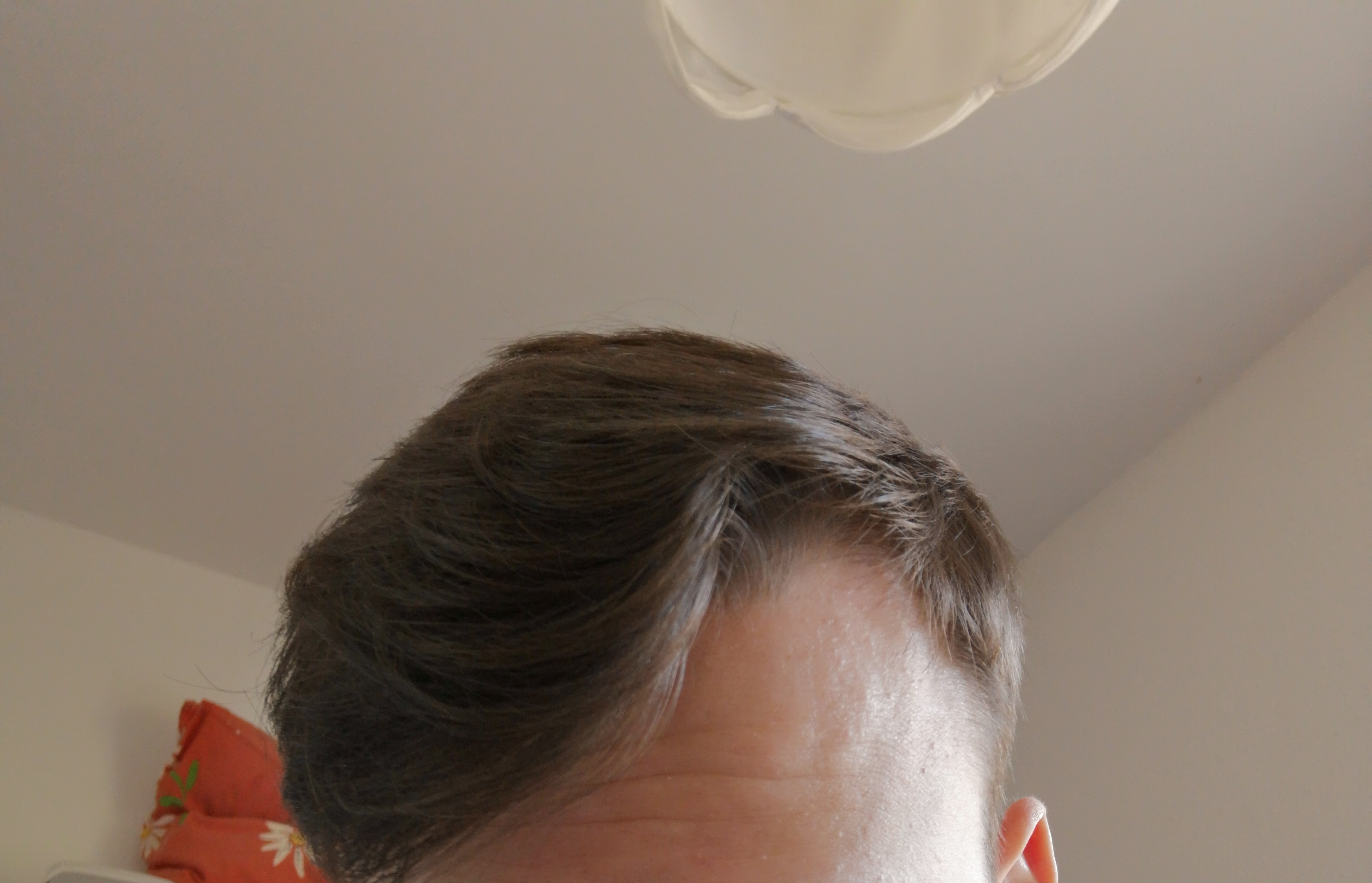 Wirbel Vorne Wegbekommen Haare Frisur