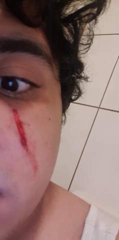 Wird Das Eine Narbe Gesundheit Und Medizin Gesundheit Wird Das Eine Narbe Gesundheit Und Medizin Gesundheit