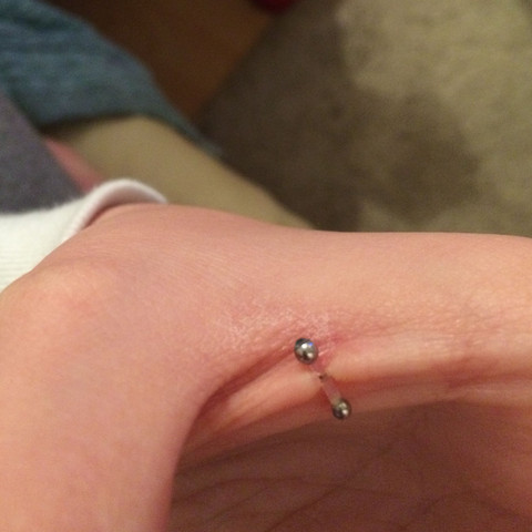 wird dieses piercing rauswachsen korper schmuck hand