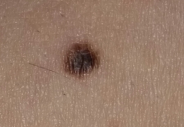 - (Medizin, Körper, Krankheit)