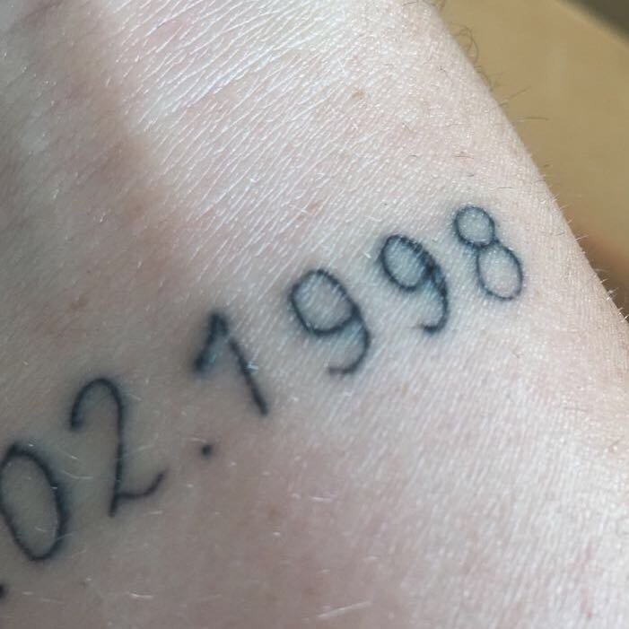 Wo lässt man Tattoos weglasern? (Geld, Körper, Schmerzen)