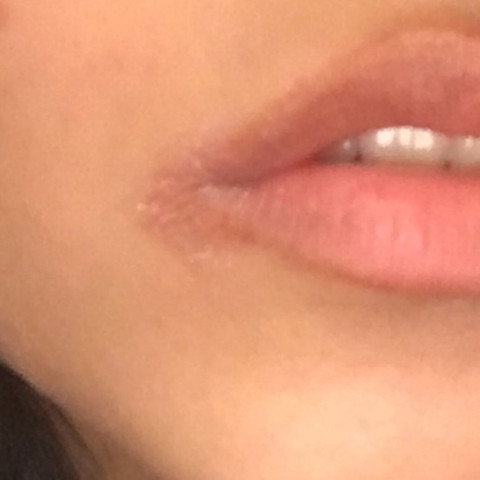 Wodurch Kommt Das An Meinem Mundwinkel Schonheit Lippe Mund