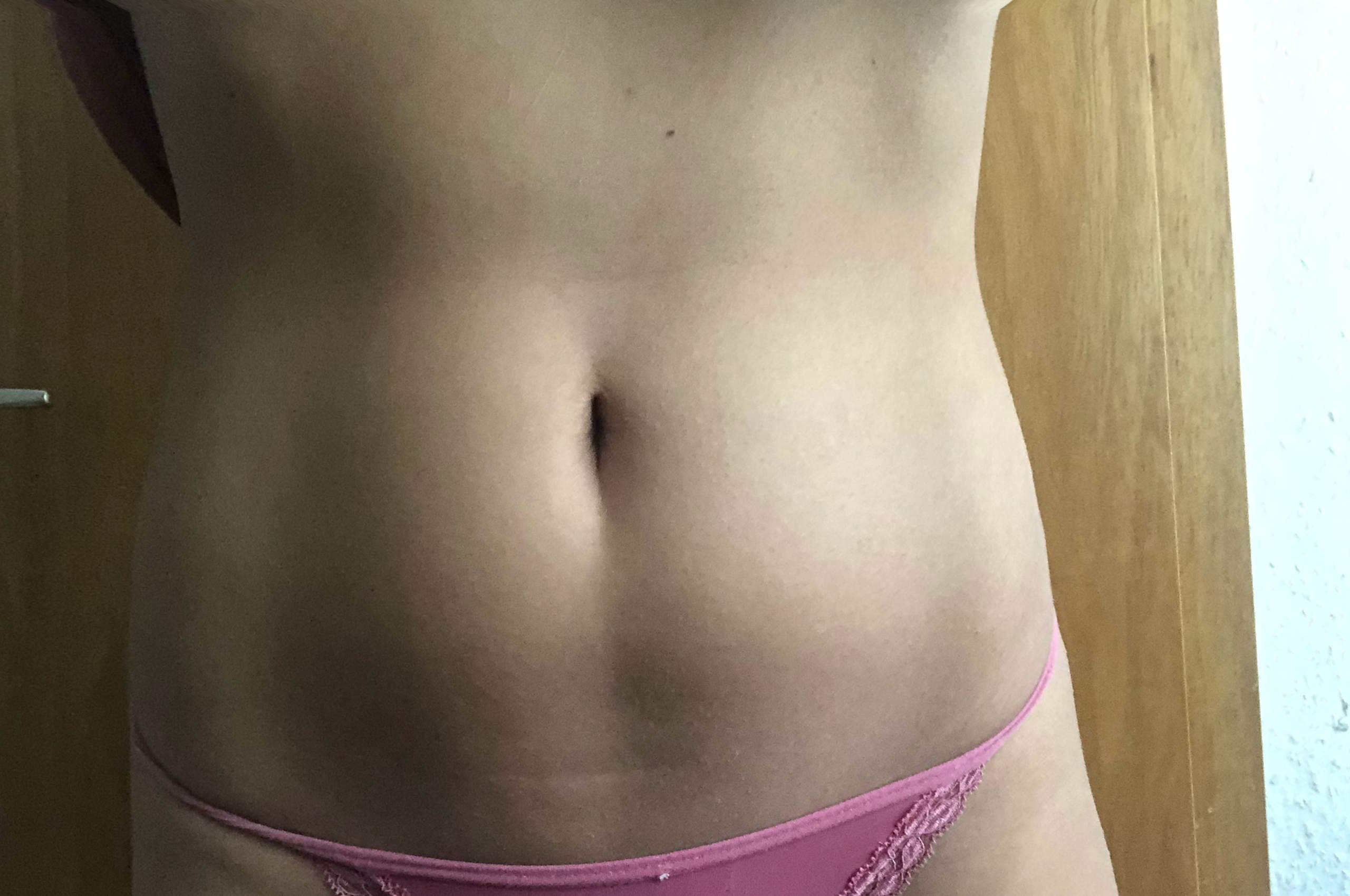 Wolbung Am Bauch Was Konnte Es Sein Krankheit Wolbung Am Bauch Was Konnte Es Sein Krankheit