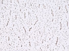 Deckenplatten 60x60 preis Deckenplatten 60x60 preis