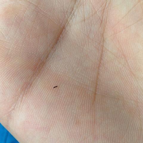 Woher Kommen Diese Ganze Lause Wenn Ich Draussen Bin Sommer Insekten Woher Kommen Diese Ganze Lause Wenn Ich Draussen Bin Sommer Insekten