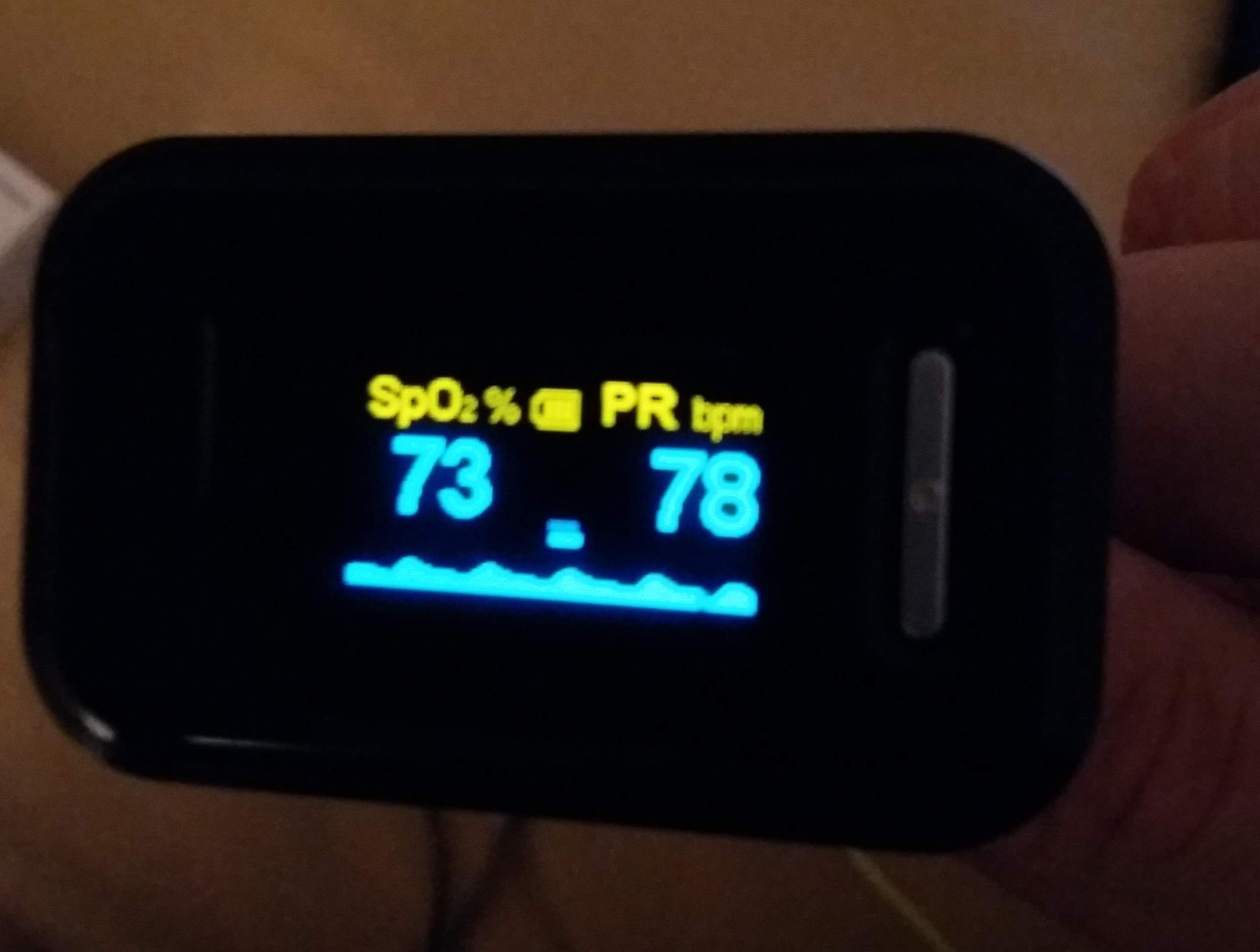 Woher wissen diese Puls-Oximeter, wie viel Sauerstoff wie wir im Blut