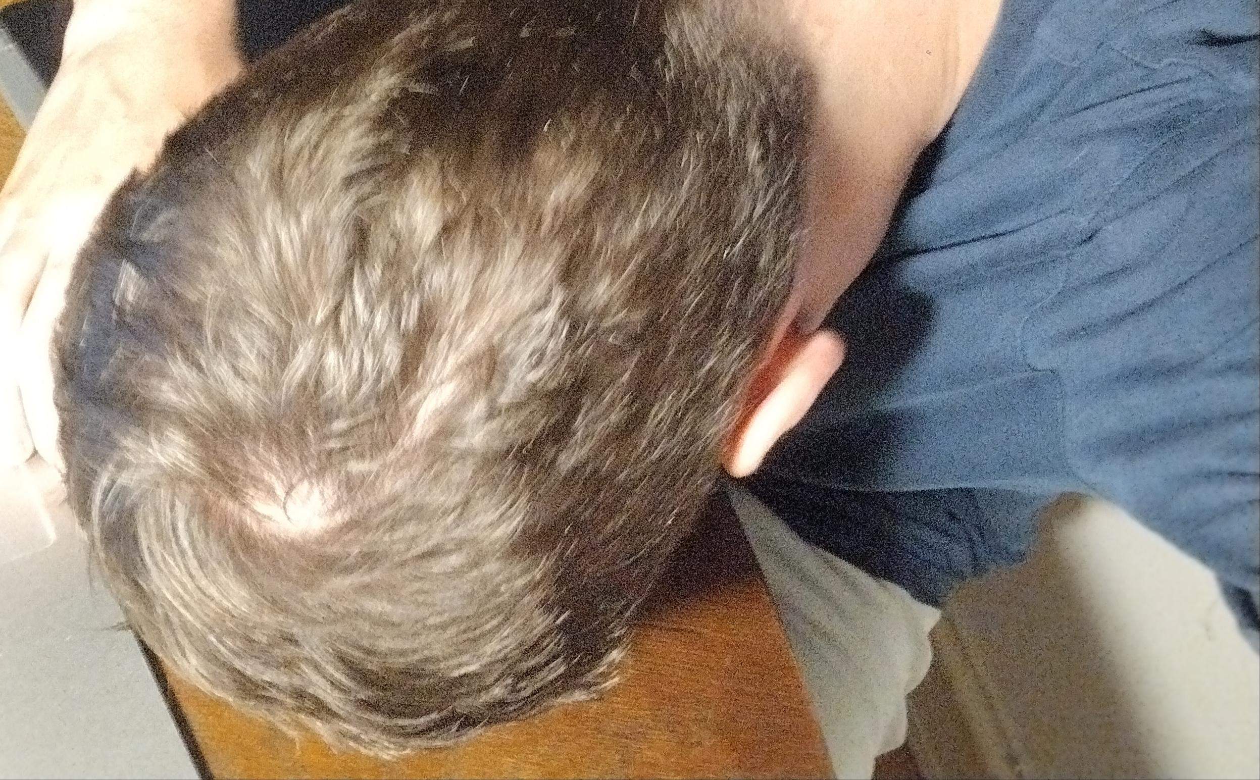 Woran erkennt man den Unterschied zwischen schlechter Frisur dominanter