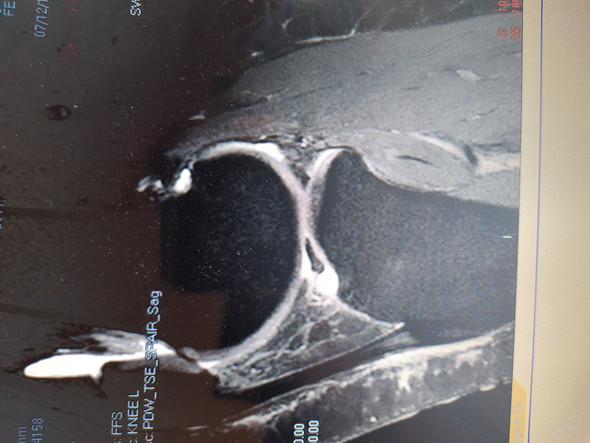 Wr kann MRT- Bilder vom Knie lesen? (Gesundheit und Medizin, Medizin, Arzt)