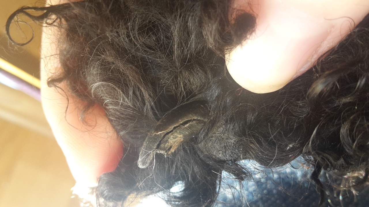 Ws tun bei Einen gebrochenem Nagel vom Hund? (Nägel)