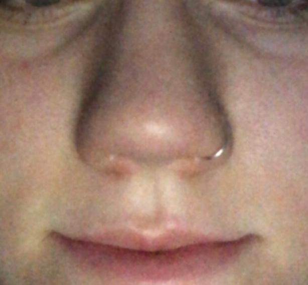 Würde mir bei dieser Nase ein Septum stehen? (Piercing, Piercingschmuck
