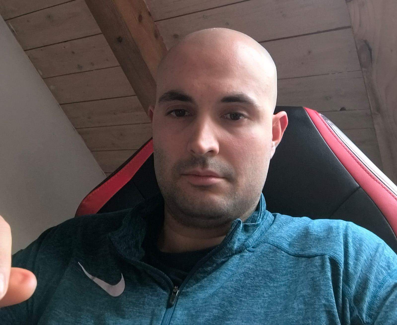 Würde mir eine Glatze eher stehen