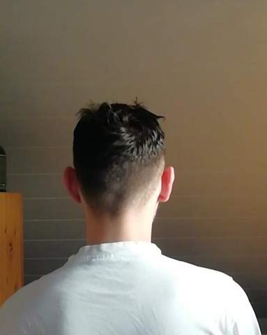 glatze oder ganz kurze haare stehen