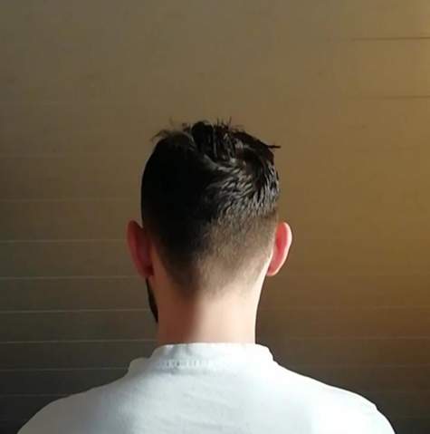 glatze oder ganz kurze haare stehen