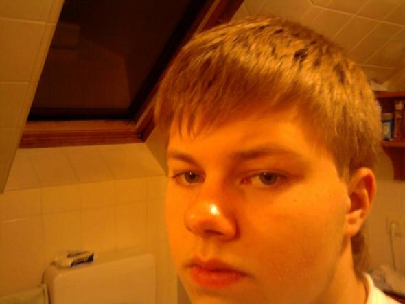 - (Haare, Kopf, Glatze)