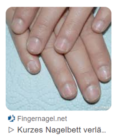 Würdet ihr als Frau eure Fingernägel so lassen (siehe Bild), wenn euer Partner das besser findet, als länger, poliert und/oder lackiert?