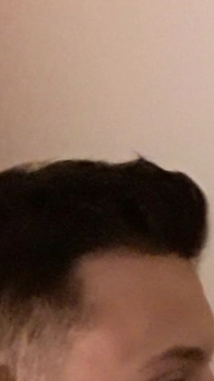 wurdet ihr sag das das haar ausfall ist