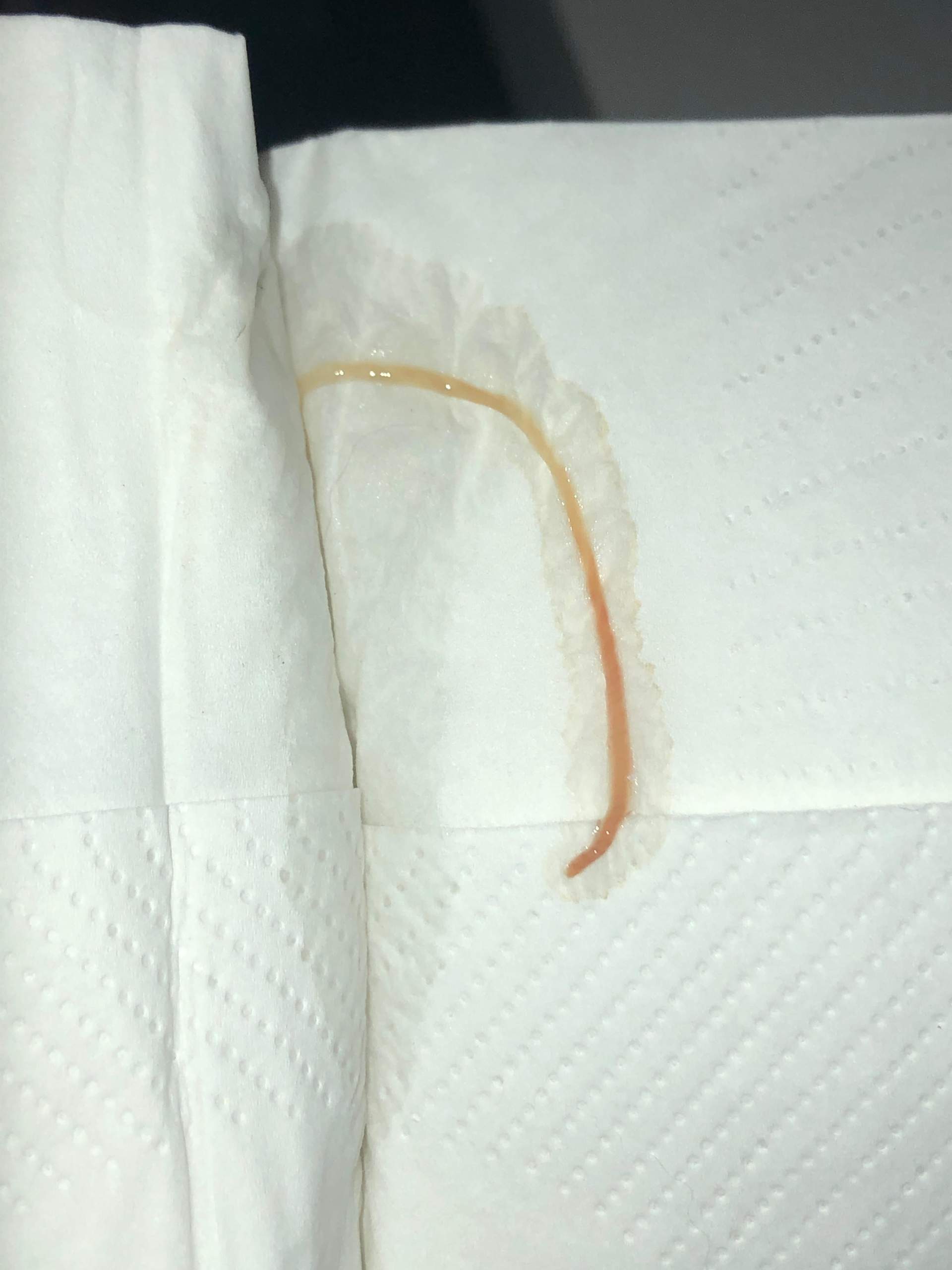 Wurm in der Nase? (Gesundheit, Medizin, HNO)