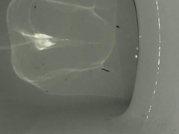 Wurm In Der Toilette Gefunden Mehrere Male Kann Mir Jemand Weiter Helfen wurm-in-der-toilette-gefunden-mehrere-male-kann-mir-jemand-weiter-helfen