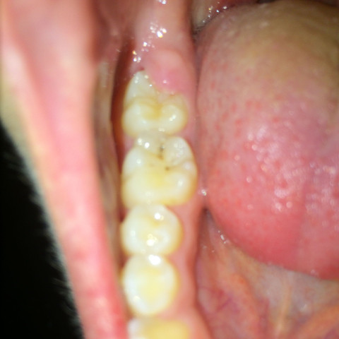 Der rechte Zahn - (Angst, Zähne, Wurzel)