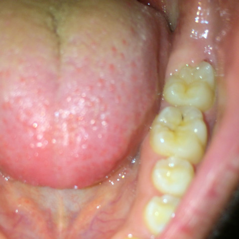 Der linke Zahn - (Angst, Zähne, Wurzel)