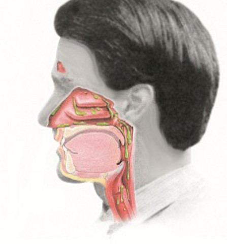 Zaher Schleim Bringt Mich Zum Wurgen Gesundheit Und Medizin Krank Erkaltung Zaher Schleim Bringt Mich Zum Wurgen Gesundheit Und Medizin Krank Erkaltung