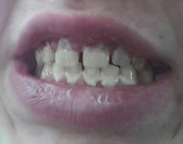 zähne - (Zähne, Zahnarzt)